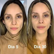 COLAGENO RENOVA